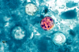 Lettuce supplier identified as potential source of cyclosporiasis outbreak